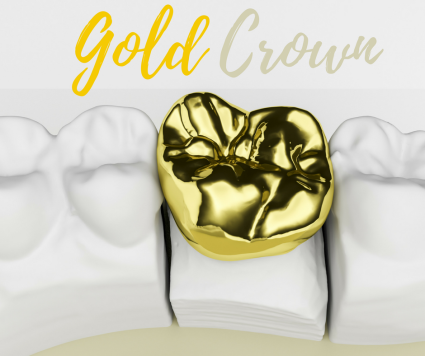 Gold Crown.png